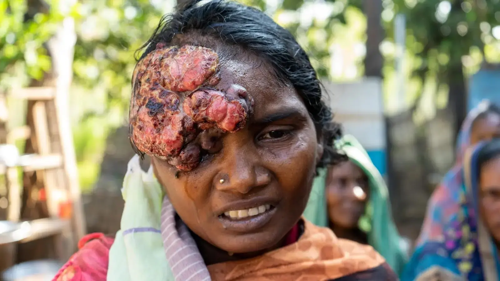 Nagamani — Before